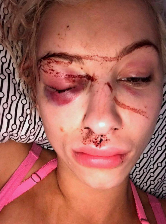 Nhìn ảnh tự sướng của bạn thân, cô gái lập tức gọi cảnh sát và giải cứu bạn sau 21 giờ kinh hoàng